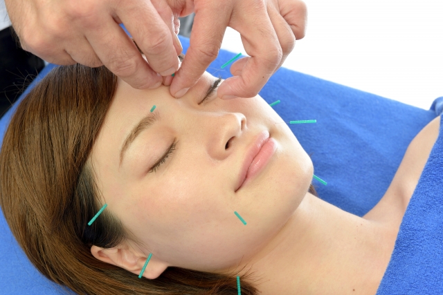 Facial Acupuncture for Acne: Clear Skin Naturally | Phase Chinese Medicine Clinic